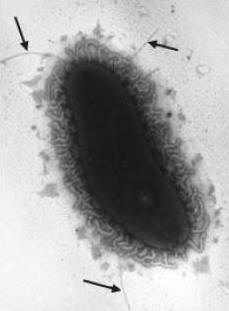 Electron micrograph of Vibrio vulnificus with arrows pointing to several fimbriae.