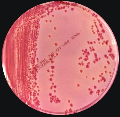 klebsiella pneumoniae gram stain