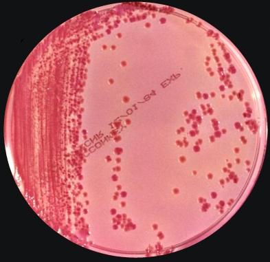 klebsiella pneumoniae gram stain morphology