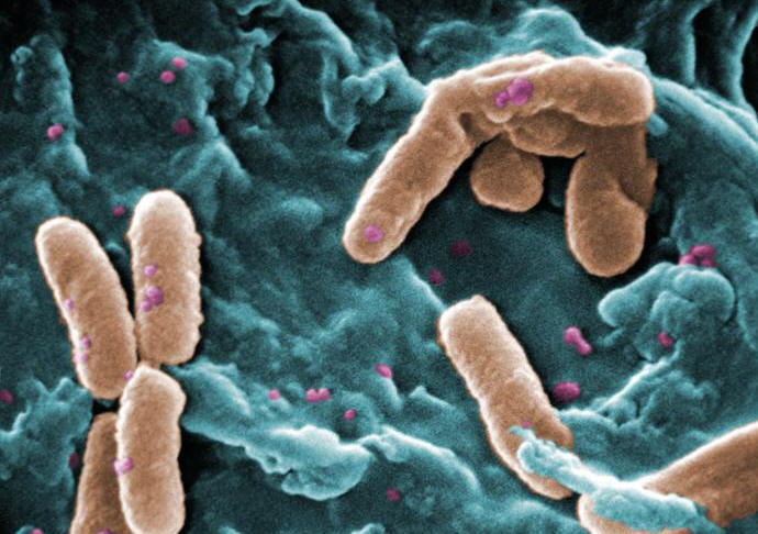 Pseudomonas aeruginosa bacteria