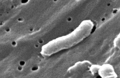 cholera bacteria gram stain