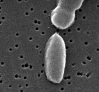 vibrio gram stain