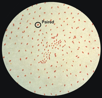 whooping cough bacteria shape