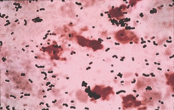 streptococci gram stain