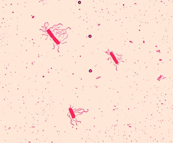 Bacillus Cereus Characteristics Chart