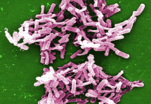 clostridium difficile spore stain