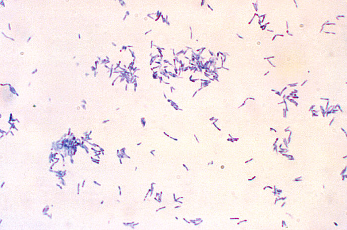 diphtheria bacteria