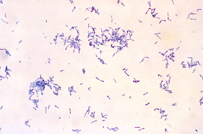 corynebacterium xerosis morphology