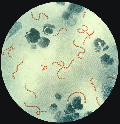 streptococci gram stain