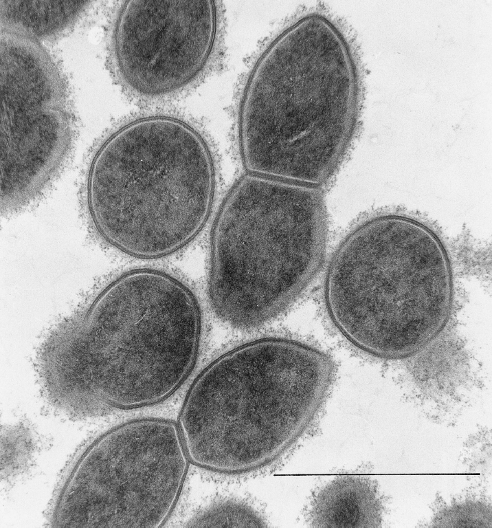 Streptococcus pneumoniae