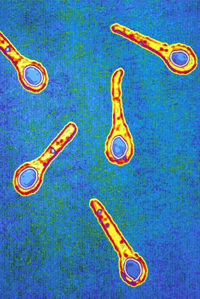 tinción de gram para clostridium tetani