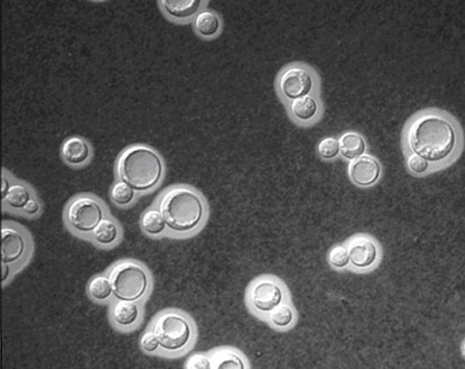 India ink test procedure for cryptococcus, capsule staining