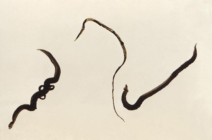 trematodes, mansoni