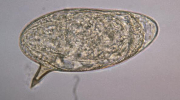 Mansoni Egg