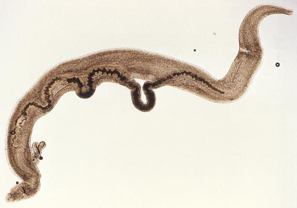 schistosoma mansoni