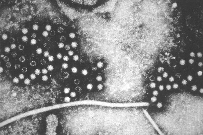 hepatitis e virus particles