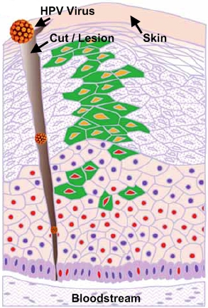 hpv virus cell structure