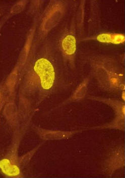 Immunofluorescence staining of influenza virus