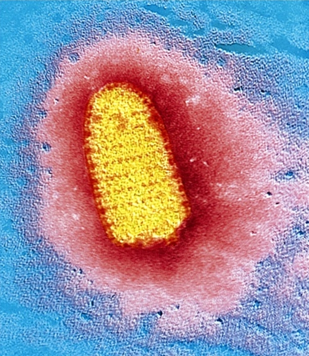 This transmission electron micrograph reveals the bullet-shaped morphology of the rabies virus